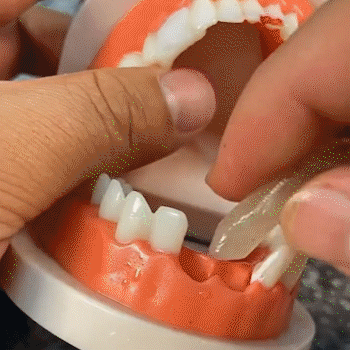 Sonrisa Instantánea y Segura