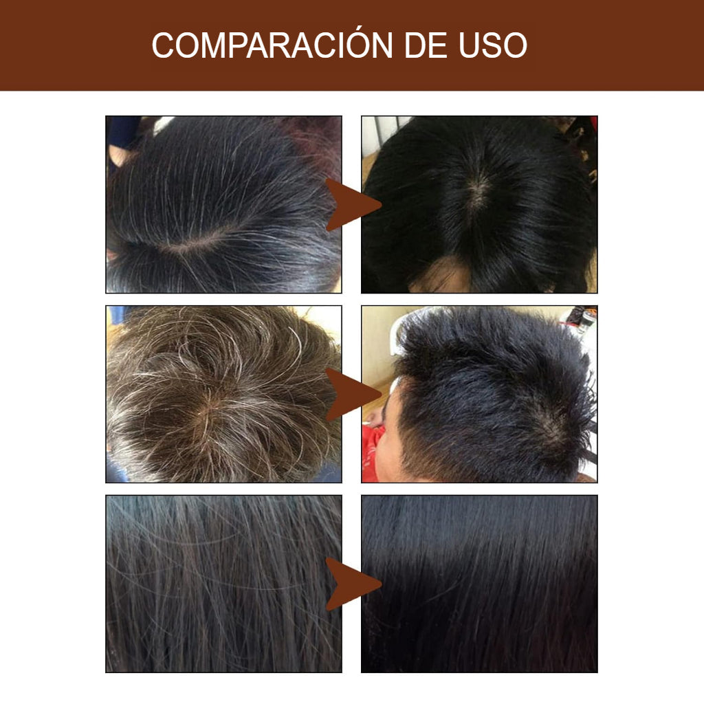 H Shampoo En Barra Anti Canas