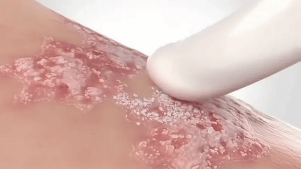 Crema Compuesta Dermatológica