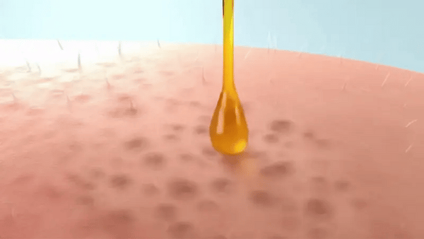 Tónico de Cúrcuma y Kojic: ¿lista para despedirte de las manchas para siempre?
