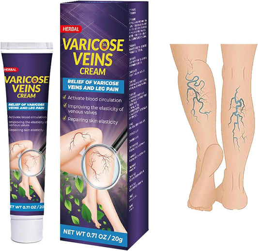 Tratamiento Venas Varices & Dolor De Piernas